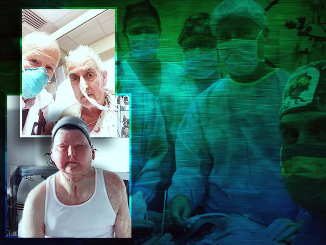 D&uuml;nyada ger&ccedil;ekleştirilen ilk organ nakilleri! Domuz kalbi, biyonik penisi y&uuml;z nakli... 