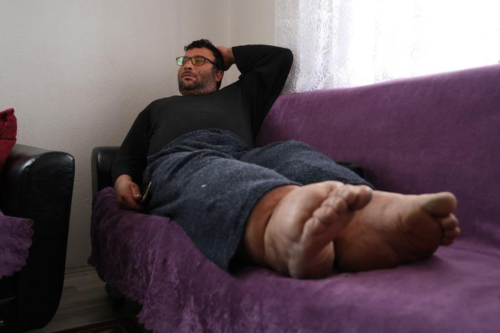 Milyonda bir görülüyor: Bu hastalığın tedavisi yok... Ayakları her yıl 7 santim büyüyor! G1