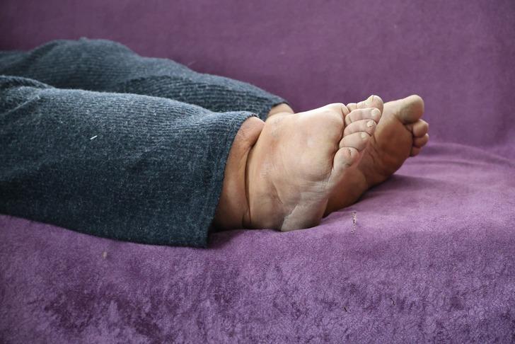 Milyonda bir görülüyor: Bu hastalığın tedavisi yok... Ayakları her yıl 7 santim büyüyor! G2