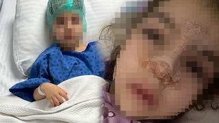 Özel kreşte ihmal iddiası! 4 yaşındaki çocuğun burnu kırıldı