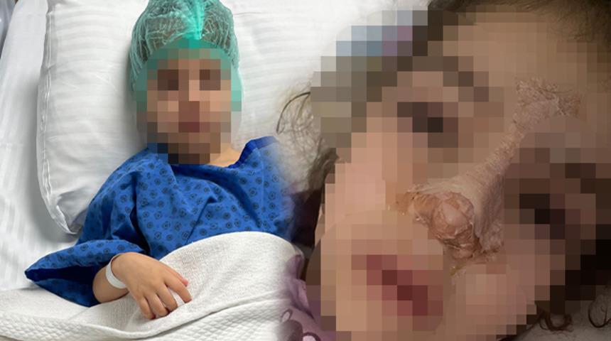 Özel kreşte ihmal iddiası! 4 yaşındaki çocuğun burnu kırıldı