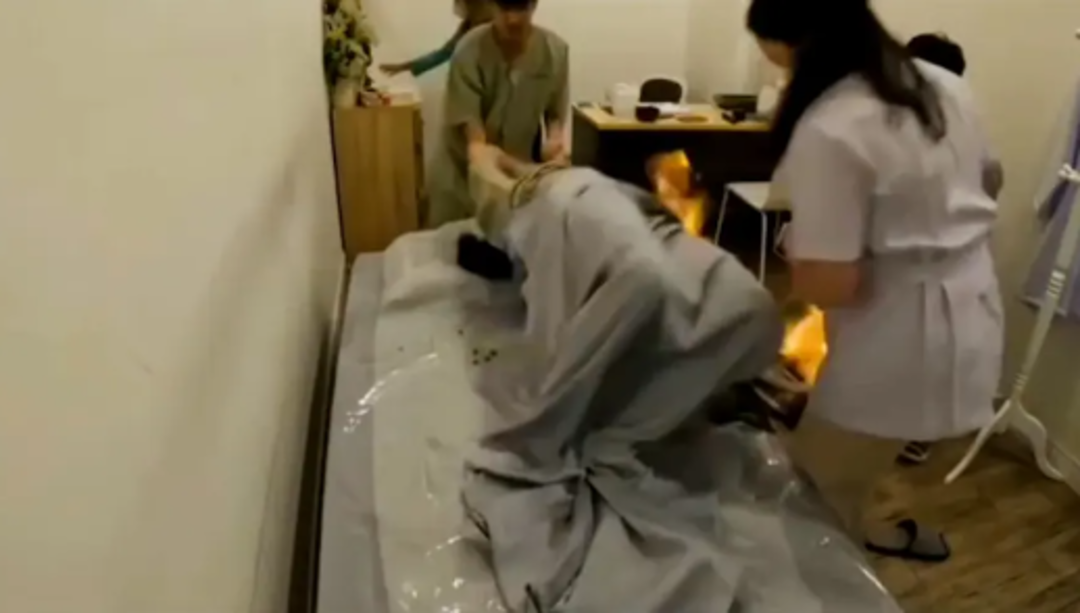 Korkun&ccedil; g&ouml;r&uuml;nt&uuml;ler! Mide sorunlarını tedavi ettirmek isteyen model diri diri yandı... Bir anda alevler y&uuml;kselince panik yaşandı