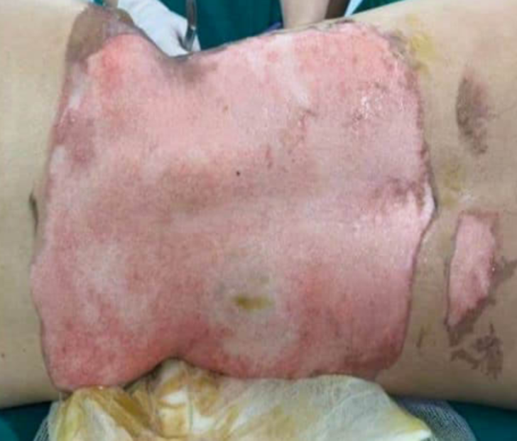 Korkunç görüntüler! Mide sorunlarını tedavi ettirmek isteyen model diri diri yandı... Bir anda alevler yükselince panik yaşandı G4