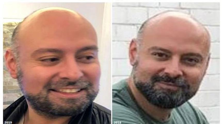 45 milyon Euro ile kaçan Türk vatandaşı ülkeyi karıştırdı! Interpol Orhan Ünal için harekete geçti…