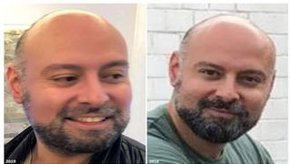 45 milyon Euro ile kaçan Türk vatandaşı ülkeyi karıştırdı! Interpol Orhan Ünal için harekete geçti…