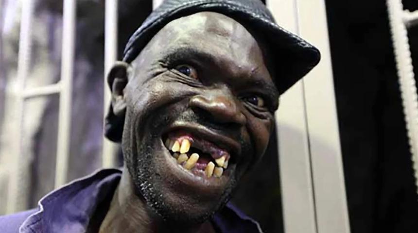 4 kez dünyanın en çirkin insanı seçilen Maison Sere ölü bulundu