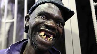 4 kez dünyanın en çirkin insanı seçilen Maison Sere ölü bulundu