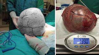 Zayıflamak için hastaneye gitti, karnından çıkan şaşkına çevirdi! 'Hamile gibi hissediyordum'