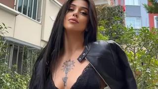 Kısmetse Olur Simge Nur Erkoç estetik kurbanı oldu! Yüzündeki sıvı akmaya başladı...