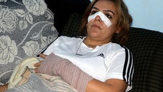 Başkanın yakınları öldüresiye dövdü! Roman kadına ‘koordinatör oldun’ dayağı