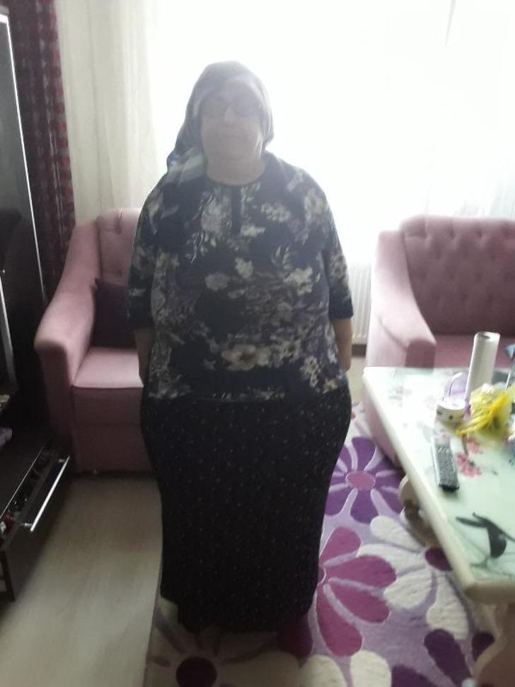 Vücudundan 25 kilo yağ dokusu çıkarttılar! 6 adım dahi atamıyordu... "Türkiye'de ve dünyada da oldukça nadir yapılan ameliyatlardan" G5