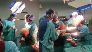 Vücudundan 25 kilo yağ dokusu çıkarttılar! 6 adım dahi atamıyordu... Türkiye'de ve dünyada da oldukça nadir yapılan ameliyatlardan