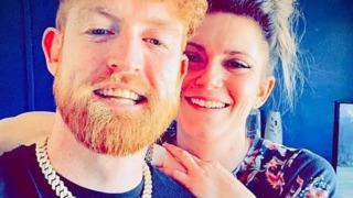 Sevgilisiyle cinsel ilişkiye girdiği sırada yatak odasına giren pitbull saldırdı! Yüzünü ve kolunu ısırdı... Sahibi köpeğini böyle savundu