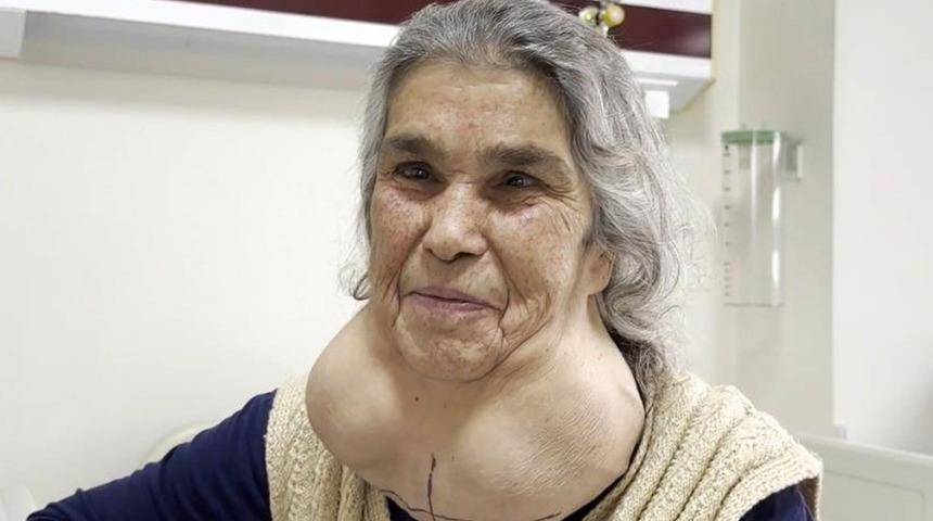 Yer Denizli… Boynunu gören doktorlar bile şaşkına döndü! ‘50 yıl’ detayını duyan inanamadı… 