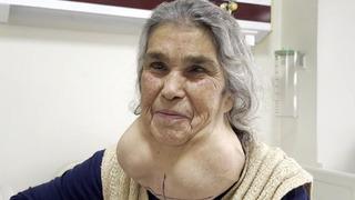 Yer Denizli… Boynunu gören doktorlar bile şaşkına döndü! ‘50 yıl’ detayını duyan inanamadı… 