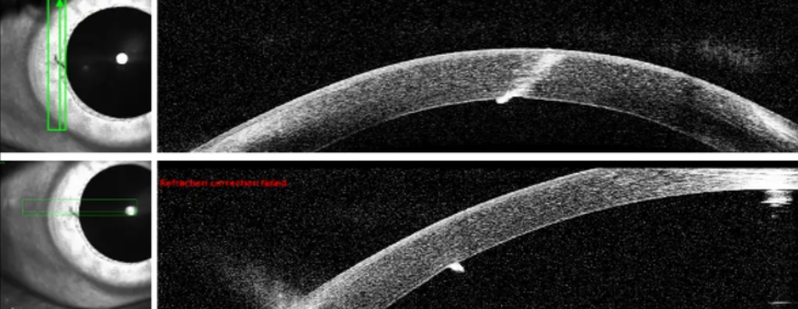 Tam 15 yıldır oradaydı! Doktorlar adamın gözüne batan kıymığı 15 yıl sonra buldu... "Bu olağanüstü" G1
