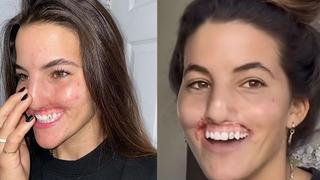 Korkunç pitbull saldırısı! Dudakları ve burnunun bir kısmını kaybetti: İskelete benziyordum