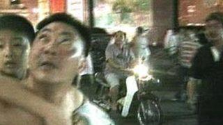 Endonezya'da verem hala öldürüyor