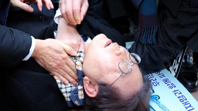 Güney Kore'de ana muhalefet liderine şoke eden saldırı! Boynundan bıçakladılar…