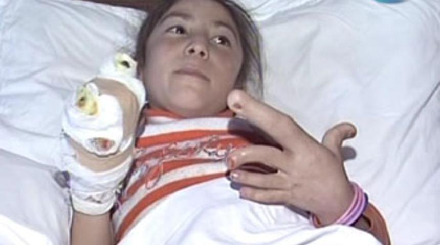 Erzurum'da dev parmaklı &ccedil;ocuk