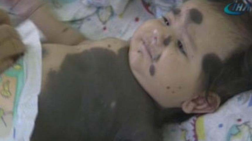 Benli bebeğin acı dramı