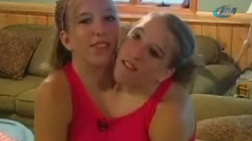 Aynı bedende iki insan