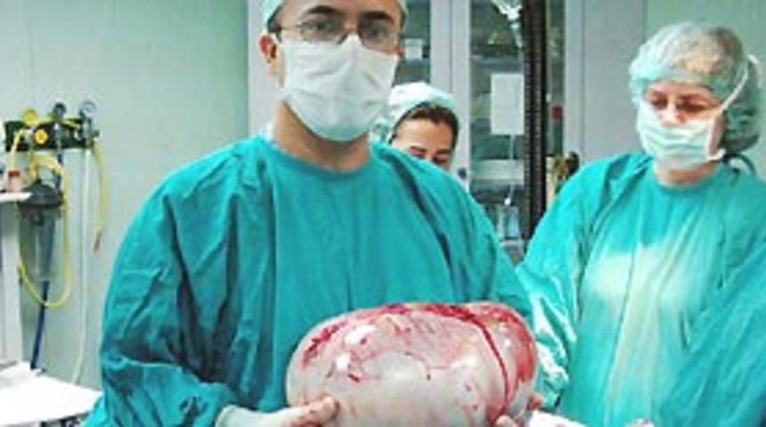 Yumurtalığından 12 kiloluk kist alındı