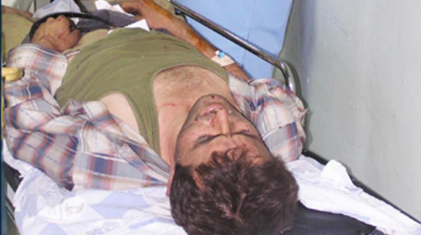 K&ouml;m&uuml;r kuyusunda patlama: 4 yaralı