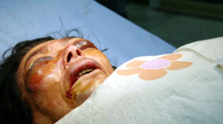 &Ouml;nce d&ouml;vd&uuml;ler sonra gasp ettiler