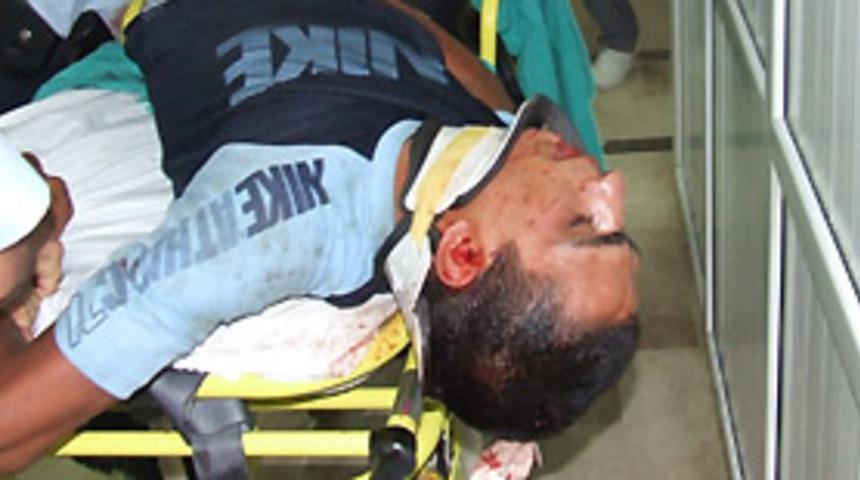 Balkondan d&uuml;şen hırsız ağır yaralandı