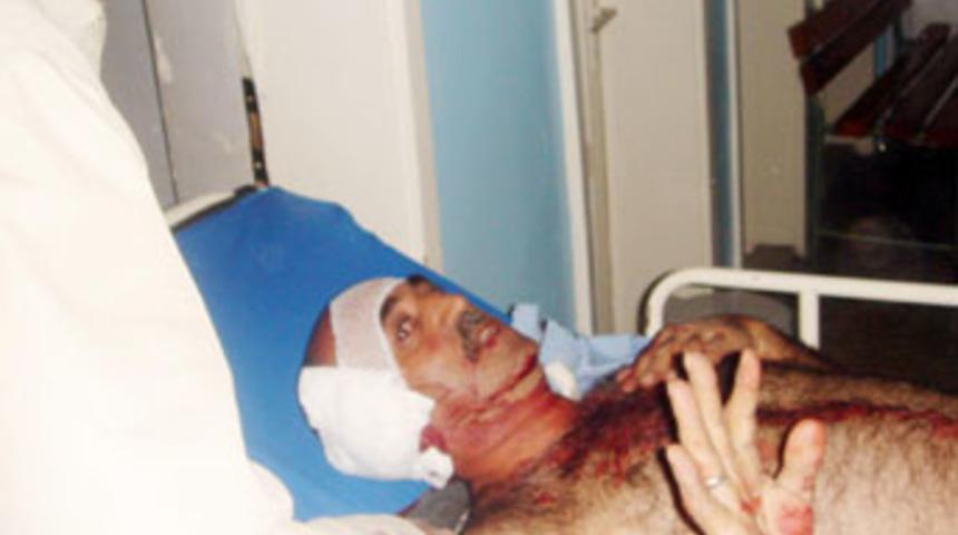 &Ouml;zel kalemin odasında silahlar konuştu: 1 &ouml;l&uuml;