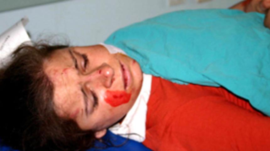 Denizli'de trafik kazası: 16 yaralı