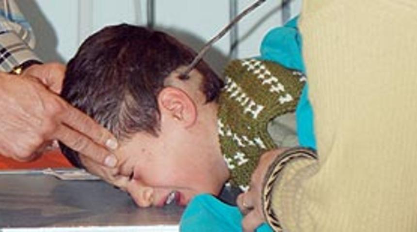 Kardeşinin kafasına soba şişi soktu