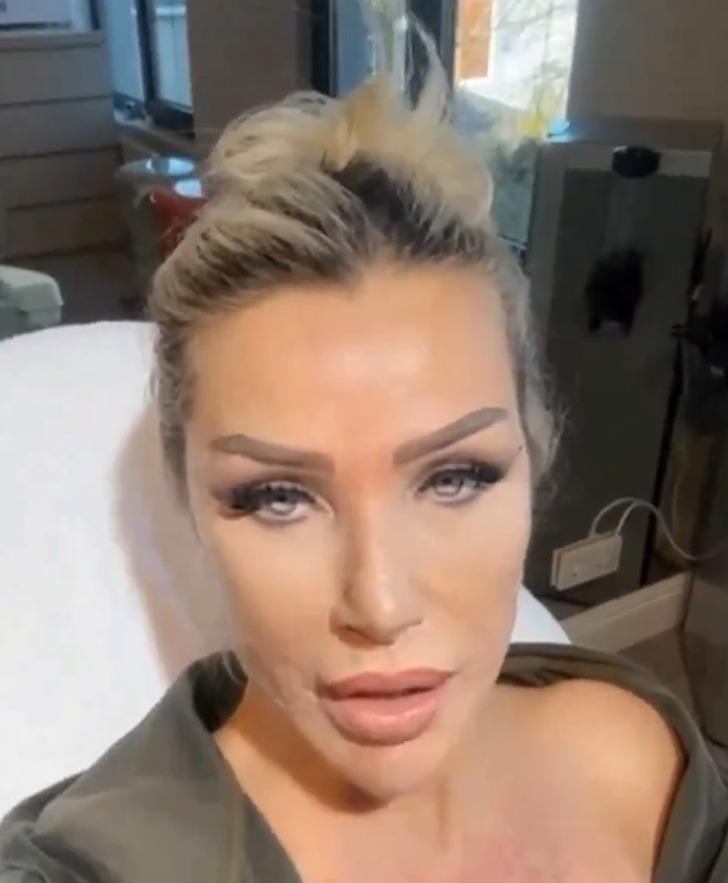 Estetikleri gündemden düşmüyor! Seda Sayan son videosuyla takipçilerini şaşırttı... Sünnet derisinden sıvı enjekte ettirdi G2