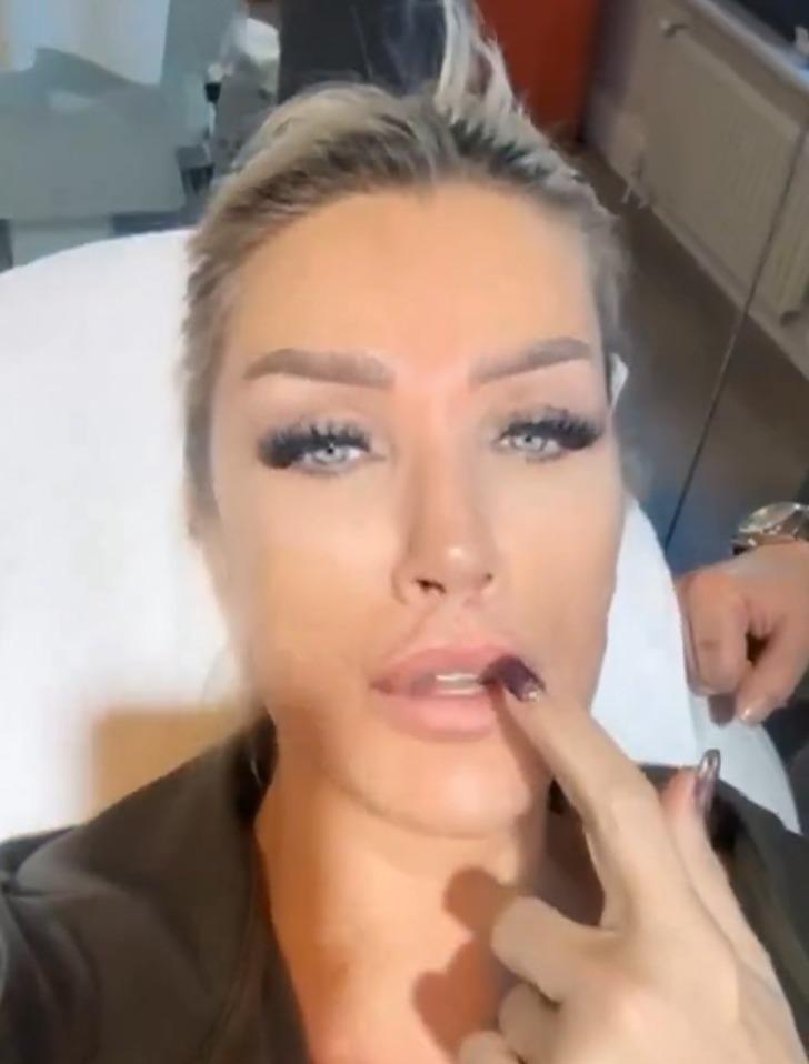 Estetikleri gündemden düşmüyor! Seda Sayan son videosuyla takipçilerini şaşırttı... Sünnet derisinden sıvı enjekte ettirdi G3