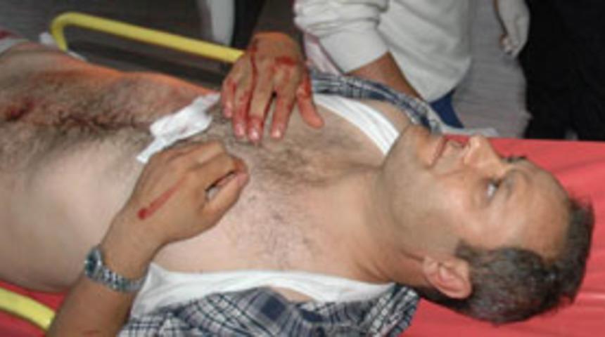 Gasp&ccedil;ıların &uuml;zerine y&uuml;r&uuml;d&uuml;, bı&ccedil;aklandı