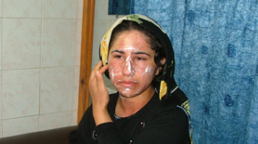 Düdüklü tencere patladı: 1 yaralı