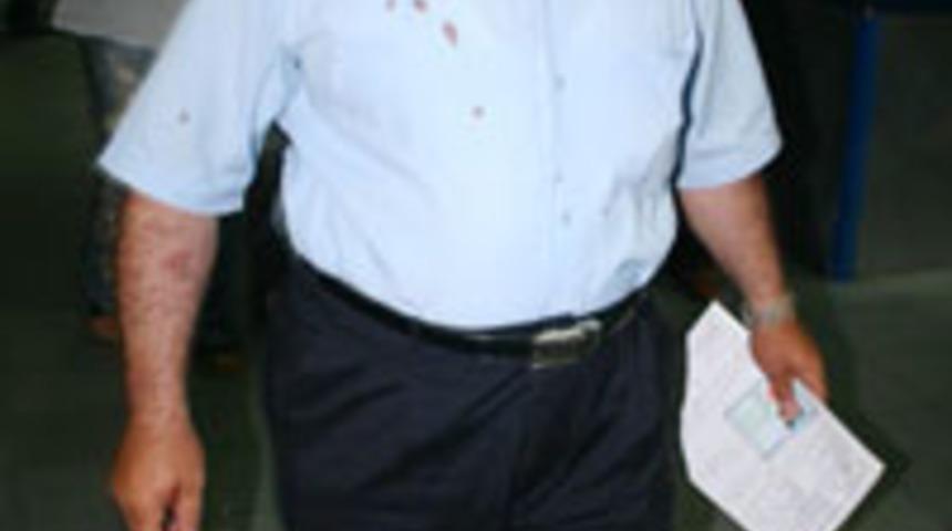 Otob&uuml;s şof&ouml;r&uuml;ne Pitbull'lu saldırı