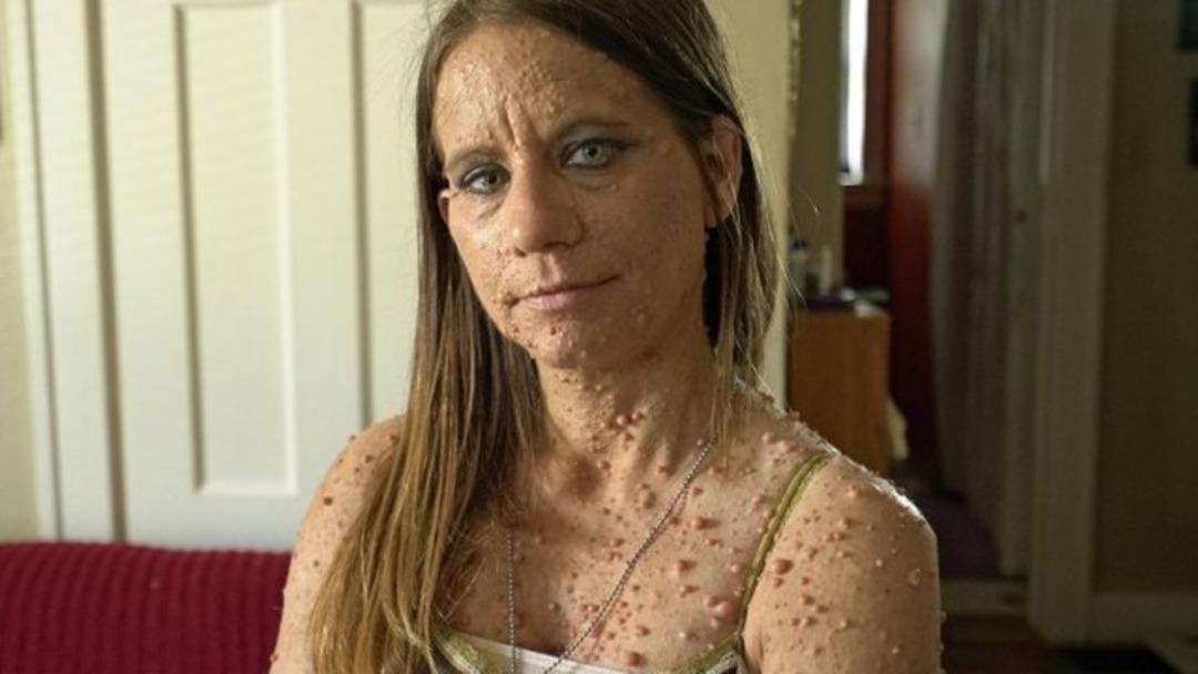 6 bin t&uuml;m&ouml;rl&uuml; kadının eski halinden eser yok