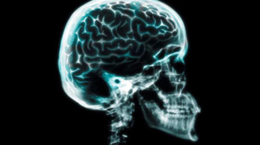 Kafatası yeniden oluştu