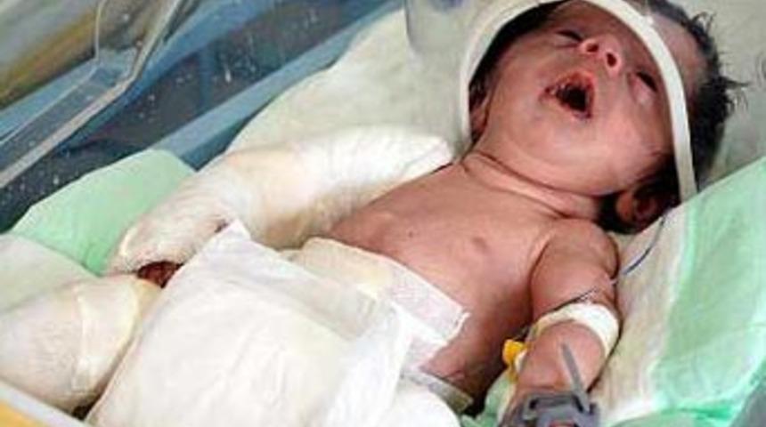 "Cam bebek" öldü