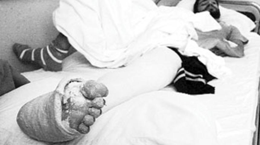 Beyin kanaması ge&ccedil;iren kişiye sağlam raporu