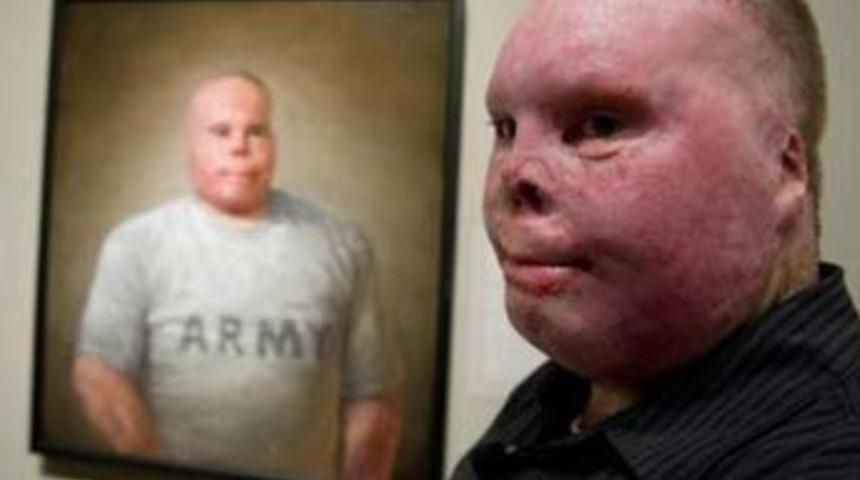 Y&uuml;z&uuml; &ouml;l&uuml;ms&uuml;zleşti