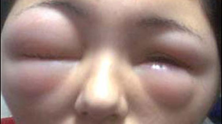 Amacı sa&ccedil;ını boyamaktı ama...