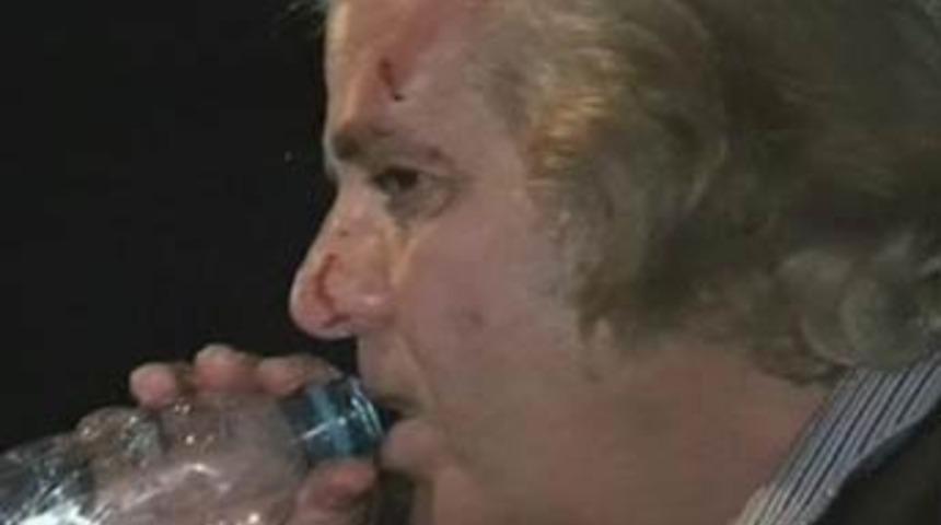 Tarık Akan'a biber gazlı, coplu saldırı