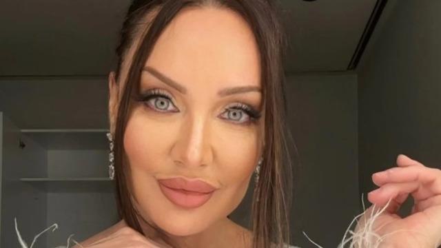 Alın daraltma estetiği yaptırmıştı... Umut Akyürek imaj tazeledi! Son haline yorum yağdı