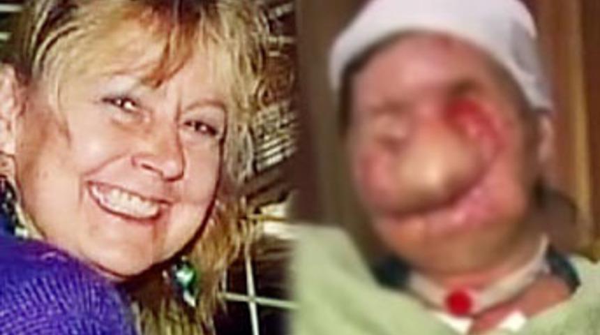 Korkun&ccedil; şempanze saldırısının kurbanı