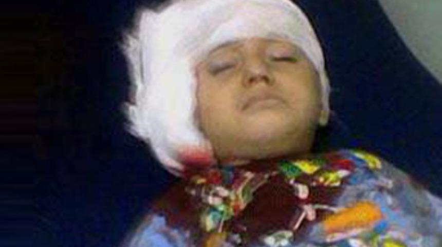 Mehmet'i gaz bombası &ouml;ld&uuml;rm&uuml;ş