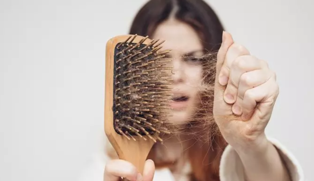 Sa&ccedil; d&ouml;k&uuml;lmenizin 5 muhtemel nedeni ve en etkili &ccedil;&ouml;z&uuml;m yolları! Yiyeceklerden ila&ccedil;lara kadar...