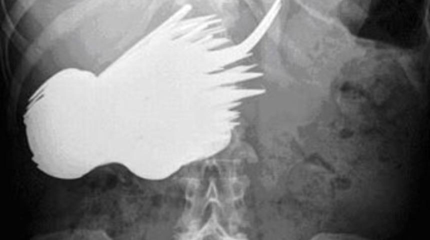 &Ccedil;atal-bı&ccedil;akla beslenmiş